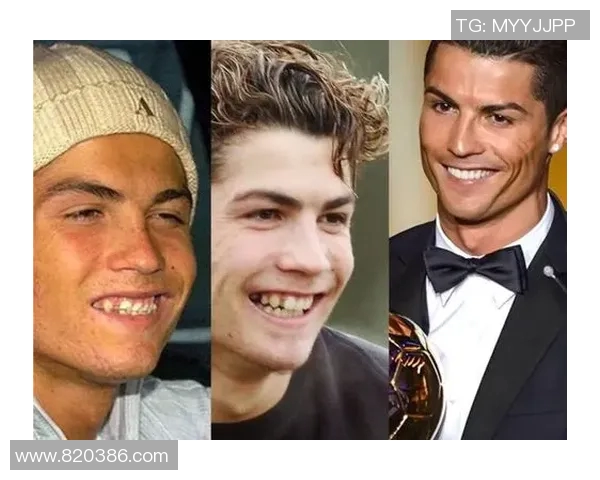 足球明星箍牙全过程高清视频揭秘让你见证明星的蜕变与魅力提升 足球明星箍牙全过程高清视频揭秘让你见证明星的蜕变与魅力提升